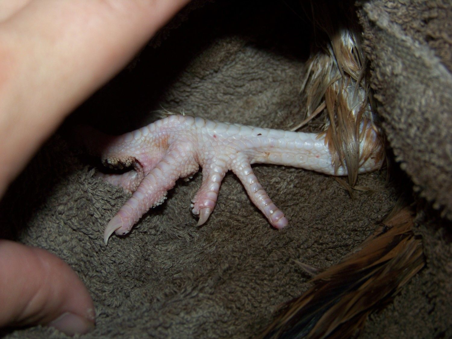 Foot fungus? *With Pic*