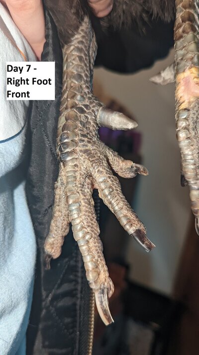 Day7-rightfoot-front.jpg