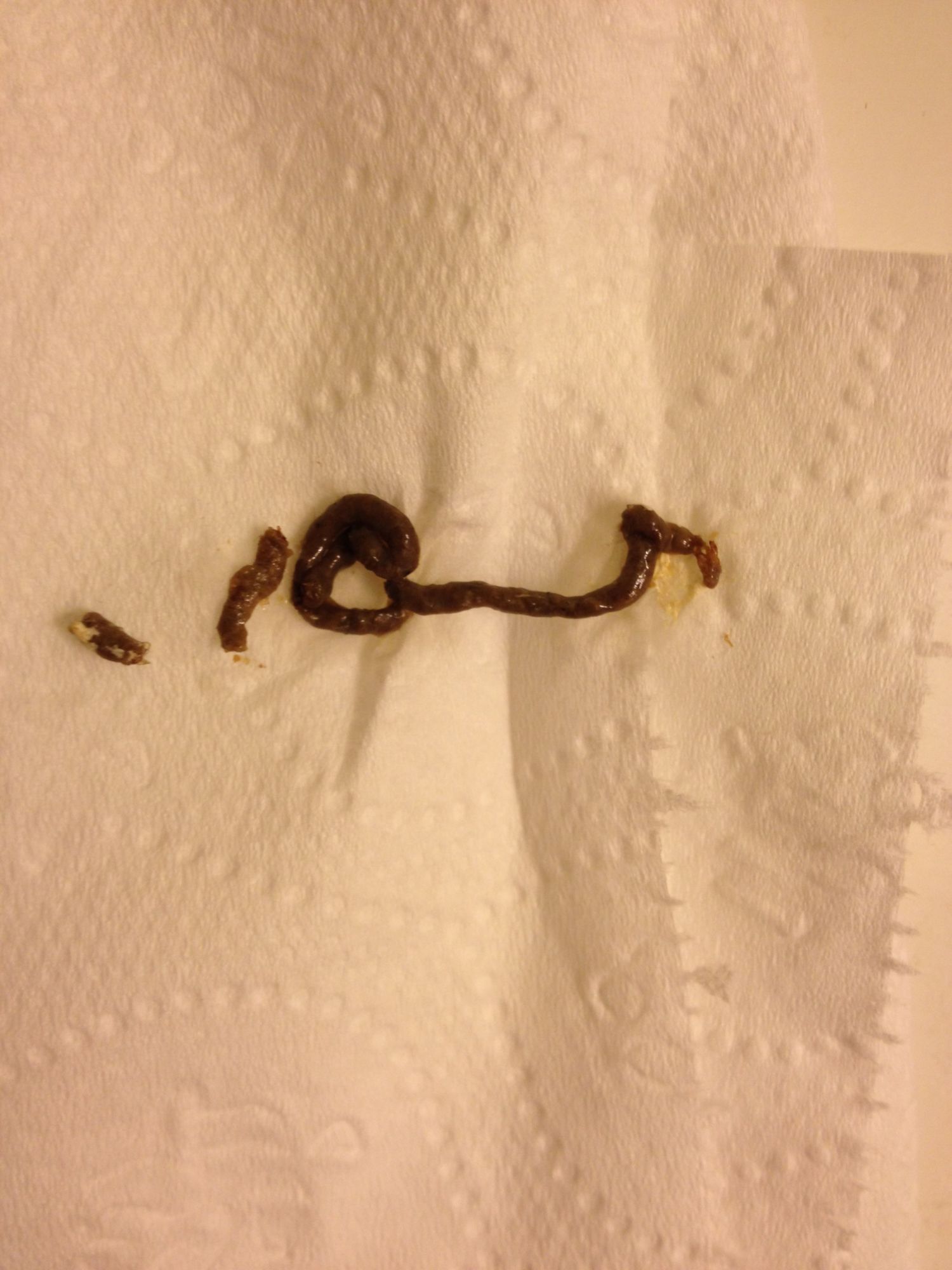 Thin worms in chick poop?