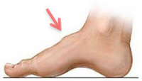 arthritis on foot.jpg