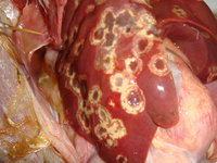 typical-blackhead-lesions-in-the-liver.jpg