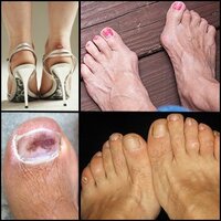 foot-pain-s3-causes-3.jpg