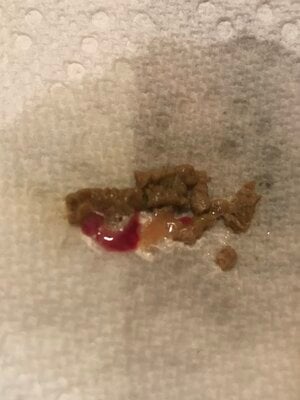 mucus poop 4f03 b97c 277a