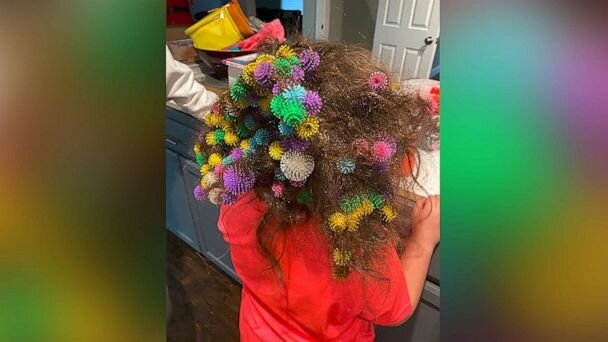 bunchems-stuck-hair1a-ht-ml-210204_1612453696597_hpMain_v2x1_16x9_608.jpg