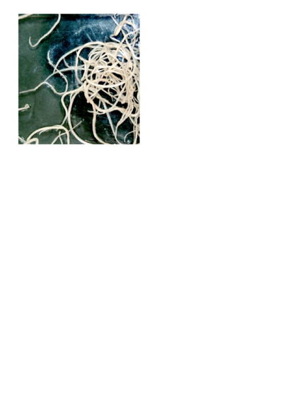 Adult-Toxocara-canis-the-most-common-intestinal-roundworm-of-dogs.png