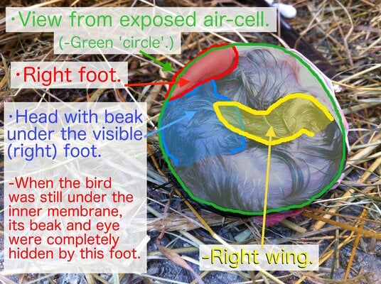 Chick Malpositioned: Head between thighs/legs/feet, in the egg...