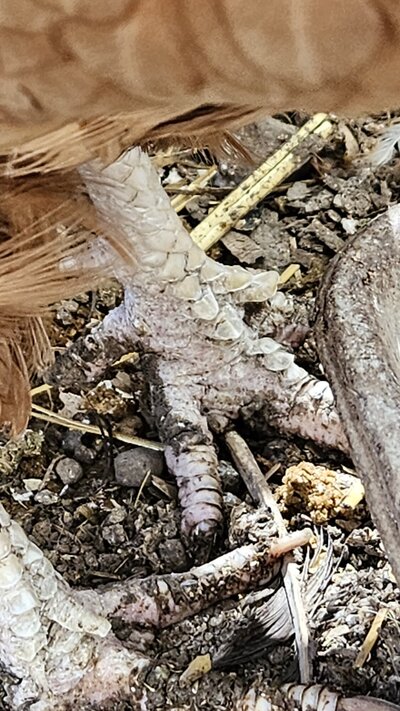 bad feet.jpg