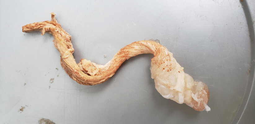 The Mystery Behind the Lash Egg That Shocked Believers Forever