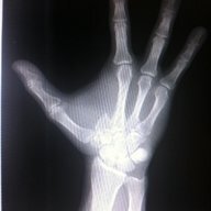 9FingerDoc