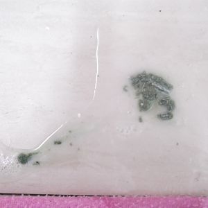 watery poop