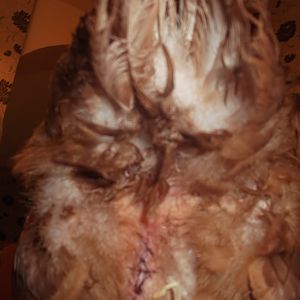 Surgery wound, poor girl