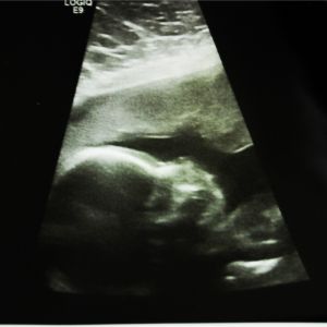 The gummi bear is the size of a bluejay feather.