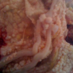 I discovered my chicken was egg bound, once I opened her up lots of fluid poured out. And 
she had what looked like tumors or nodules all along her intestines. They look like round light beige\white cottage cheese curds. I cut open open, It was a capsule with white center. The vet does not know what they are and a sample can be sent to a lab to find out. Has any one else seen this or know what they are? I'll try and add pictures.