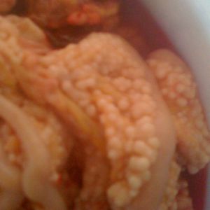 I discovered my chicken was egg bound, once I opened her up lots of fluid poured out. And 
she had what looked like tumors or nodules all along her intestines. They look like round light beige\white cottage cheese curds. I cut open open, It was a capsule with white center. The vet does not know what they are and a sample can be sent to a lab to find out. Has any one else seen this or know what they are? I'll try and add pictures.