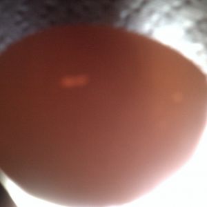 RIR#3 egg candleing Day14 nothing at all (no veins no movement)