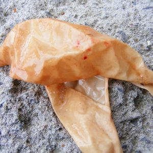 soft eggshell removed from hen