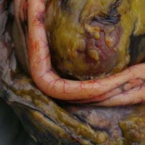 Blood supply to the duodenum clearly visible. This is where most of the digestion occurs. The pancreas ( the flatter bit between the two main tubes) secretes enzymes to help digestion.