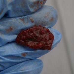 Kidney cut open. I'm not sure if this is normal.