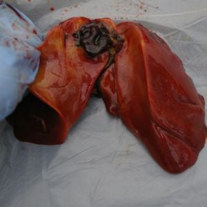 Abnormal liver.