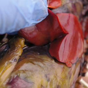 Liver has lobes