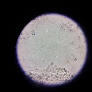 Coccidia Invasive Forms under microscope