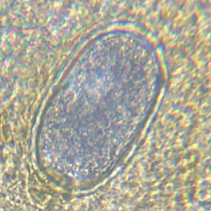 Cecal Worm Egg