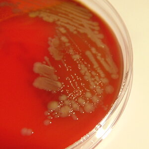 Bacteria on Blood Agar
