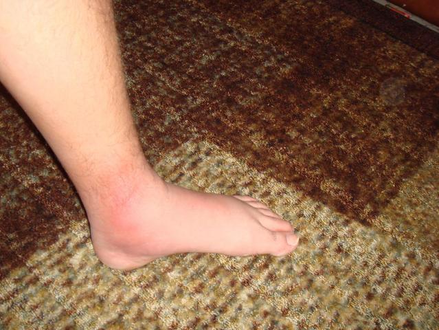 109472_ankles_002.jpg