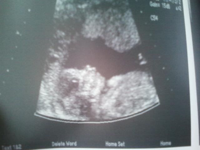 22179_ultrasound.jpg