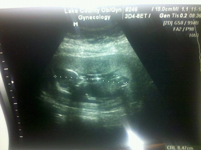 24137_baby_van_eck.jpg
