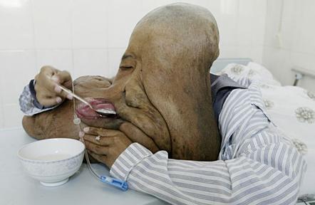 24884_chineseelephantman.jpg