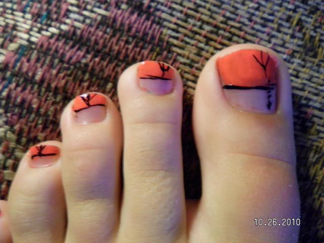 35329_toenail_001.jpg