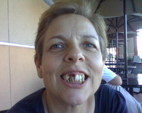 59404_teeth_before.jpeg