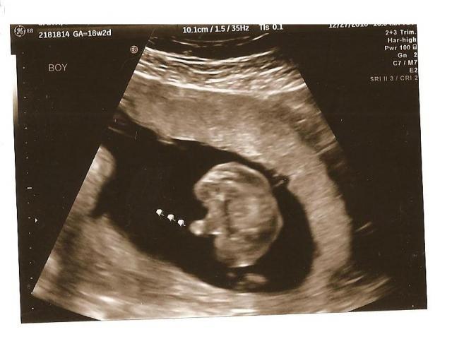 61589_18_weeks_boy_postable.jpg