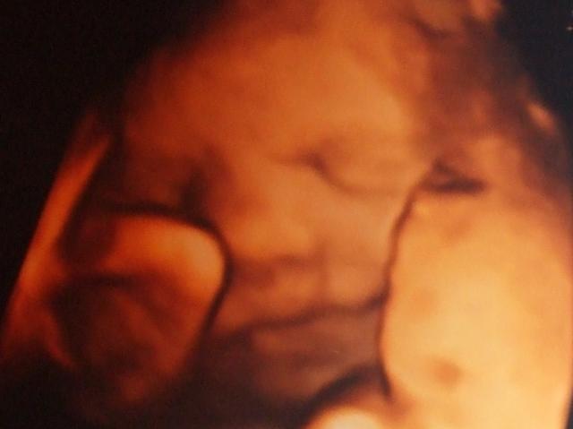 61589_tobias_31_weeks.jpg