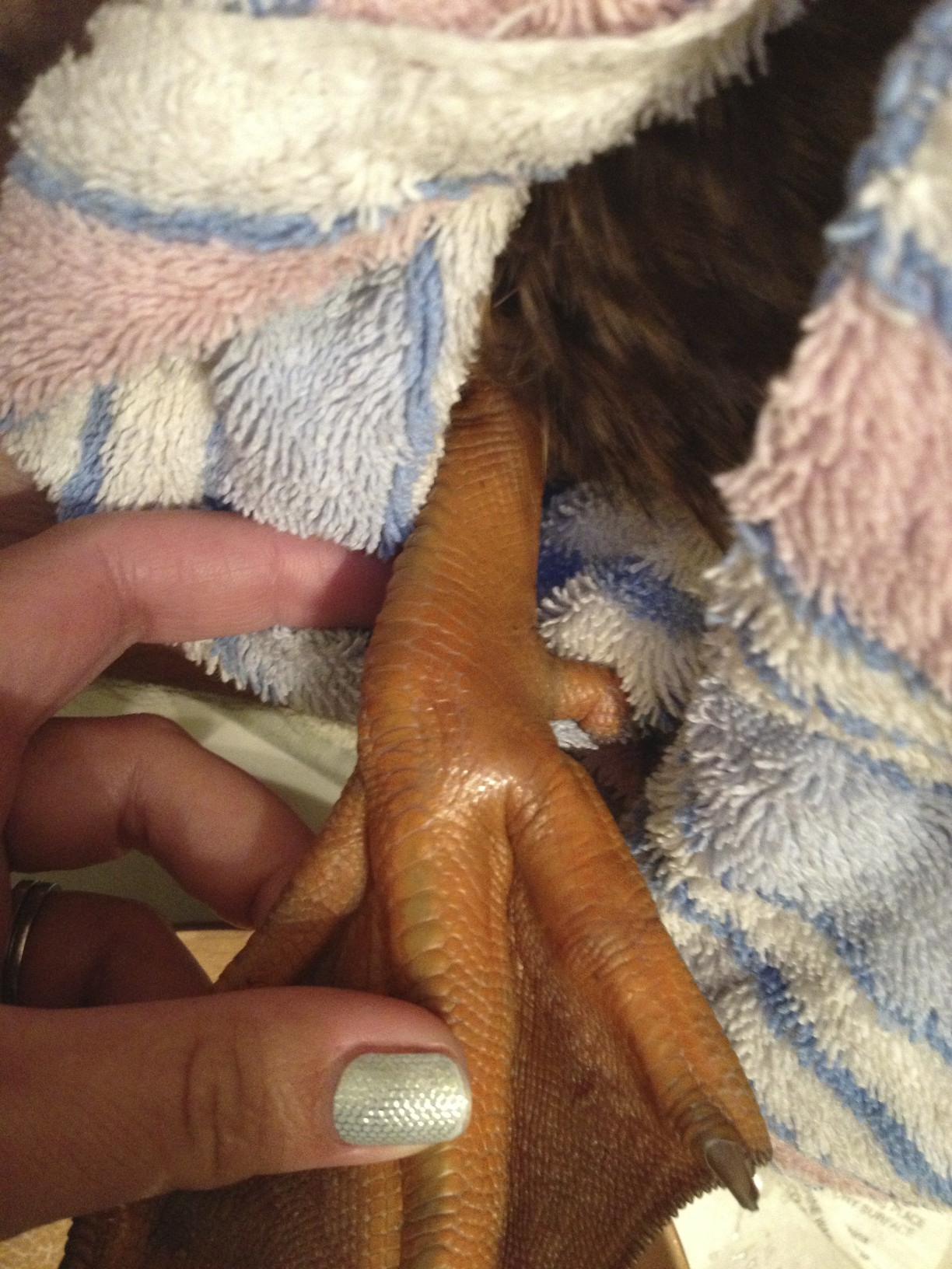 1st photo of top of foot - swollen but assumed it was from the bottom of foot
