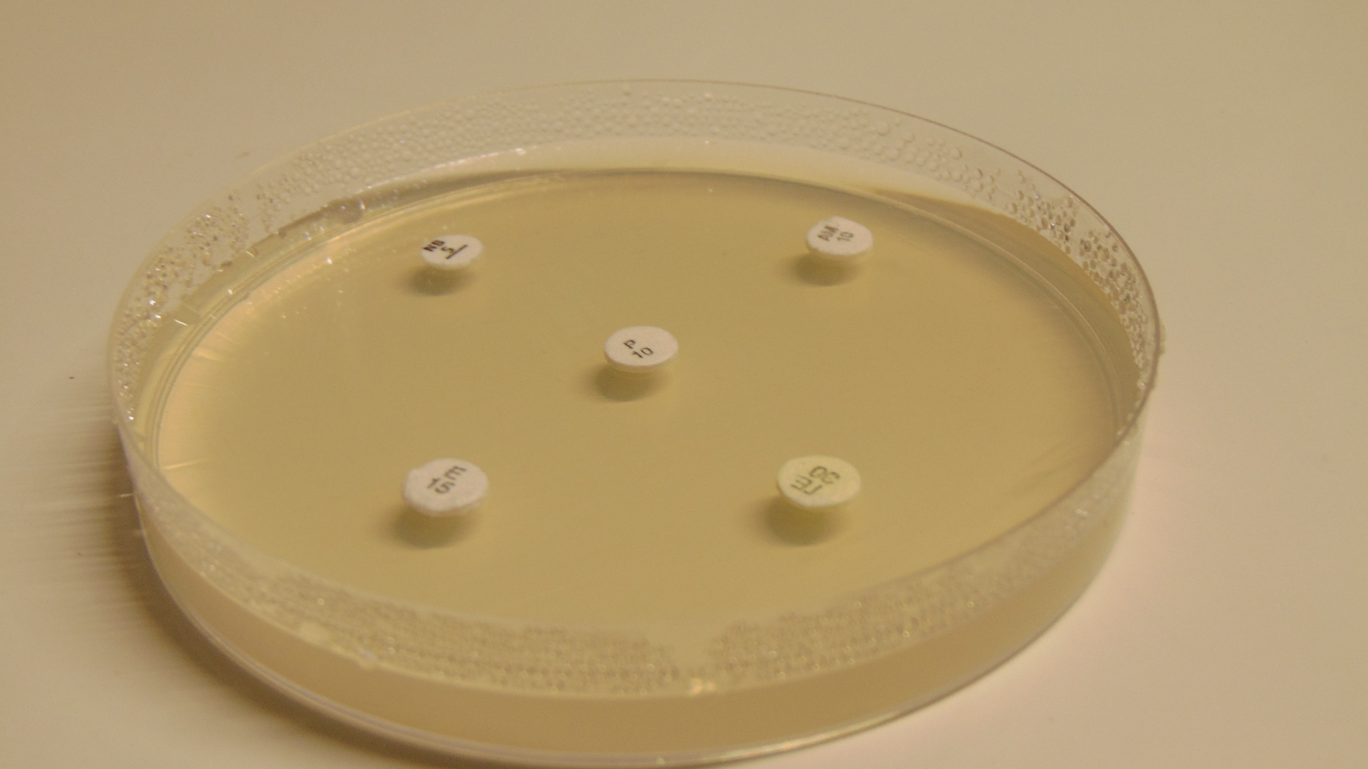 Antimicrobial Susceptibility Test