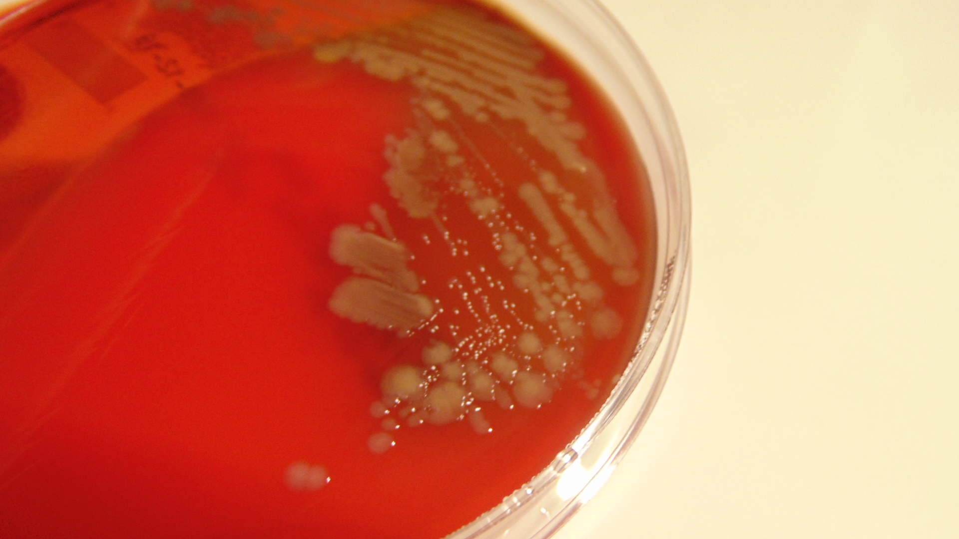 Bacteria on Blood Agar
