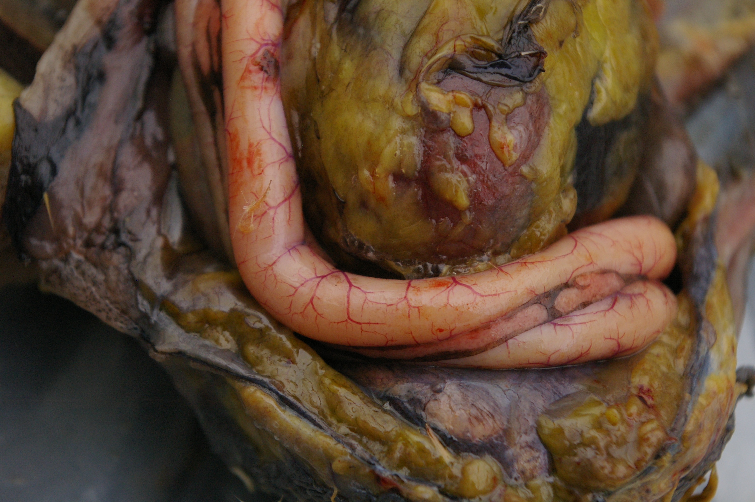 Blood supply to the duodenum clearly visible. This is where most of the digestion occurs. The pancreas ( the flatter bit between the two main tubes) secretes enzymes to help digestion.