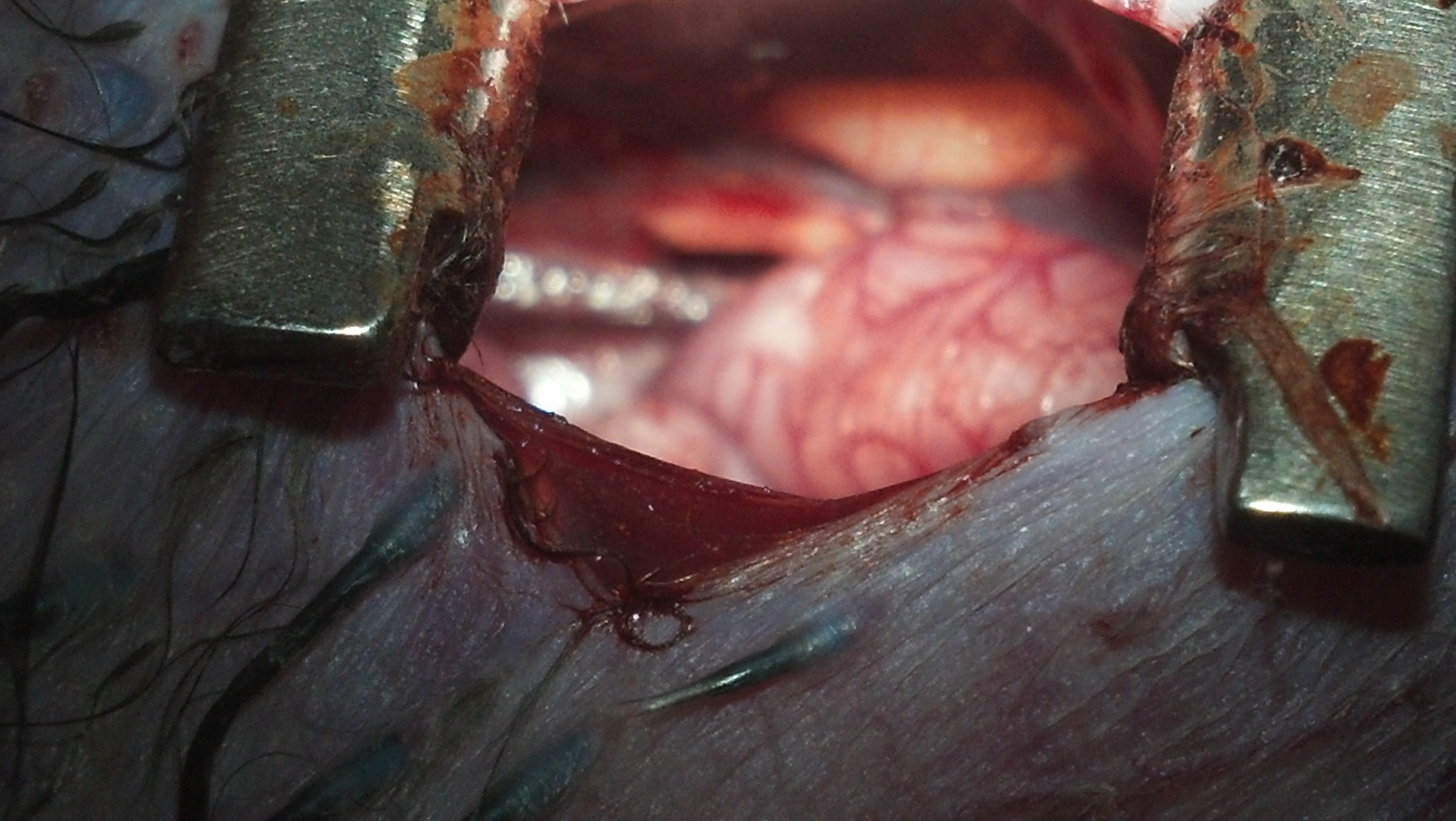 Both testicles....a 7 week old cockerel.....removed from one side.