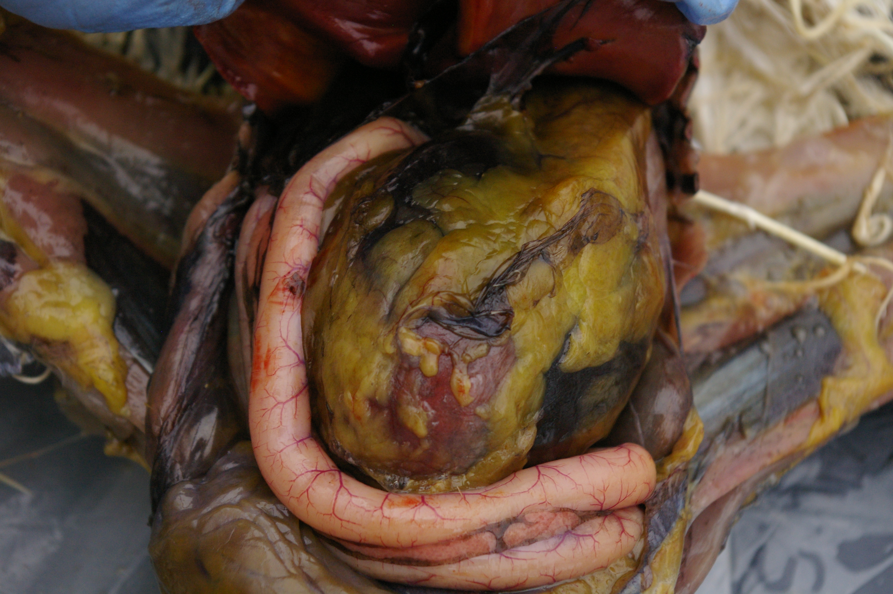 Cavity open.
Large ball that's covered in fat deposits is the Gizzard. They are HUGE
Pink is the Duodenum and pancreas