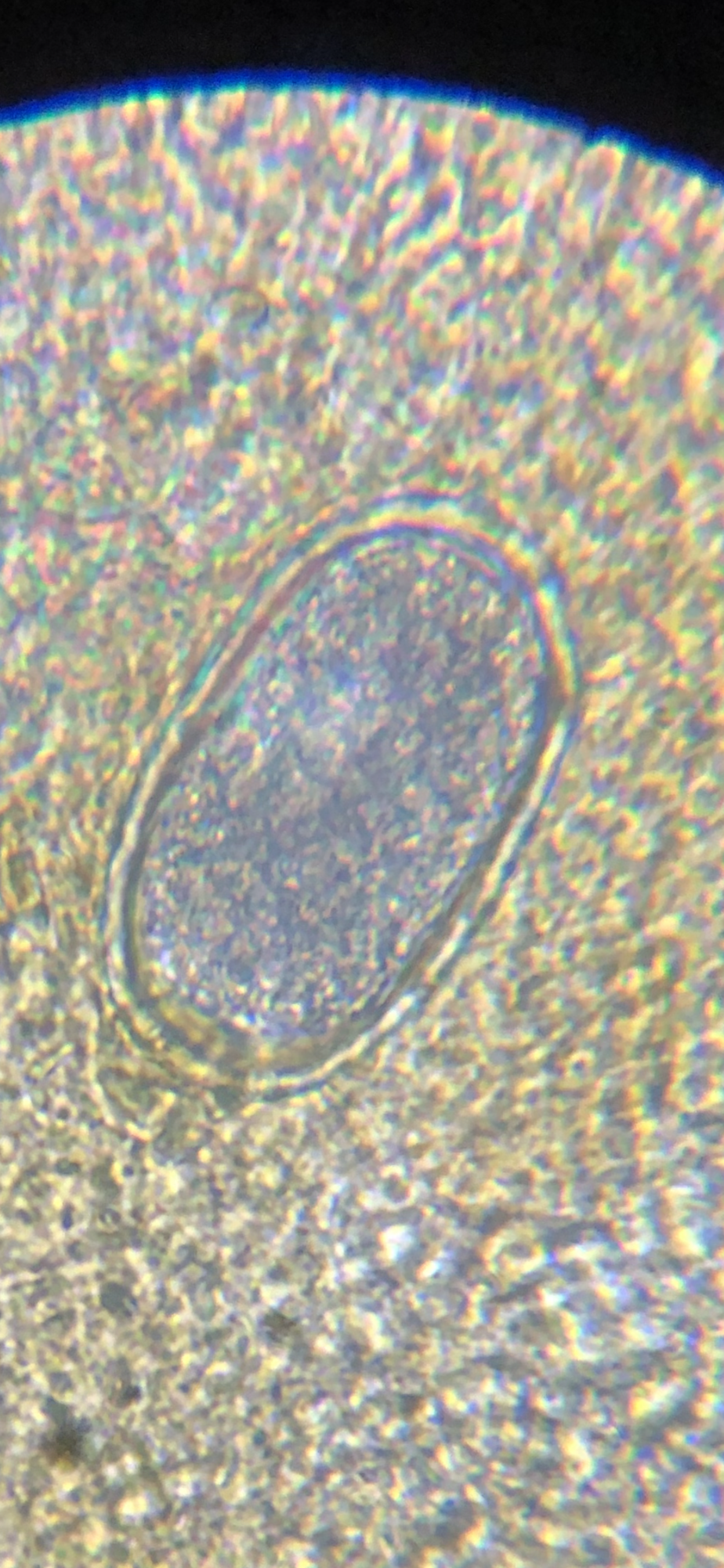 Cecal Worm Egg
