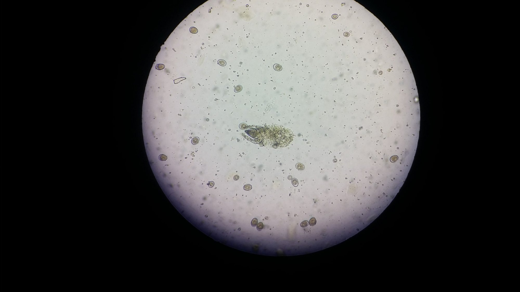 Coccidia and Mite