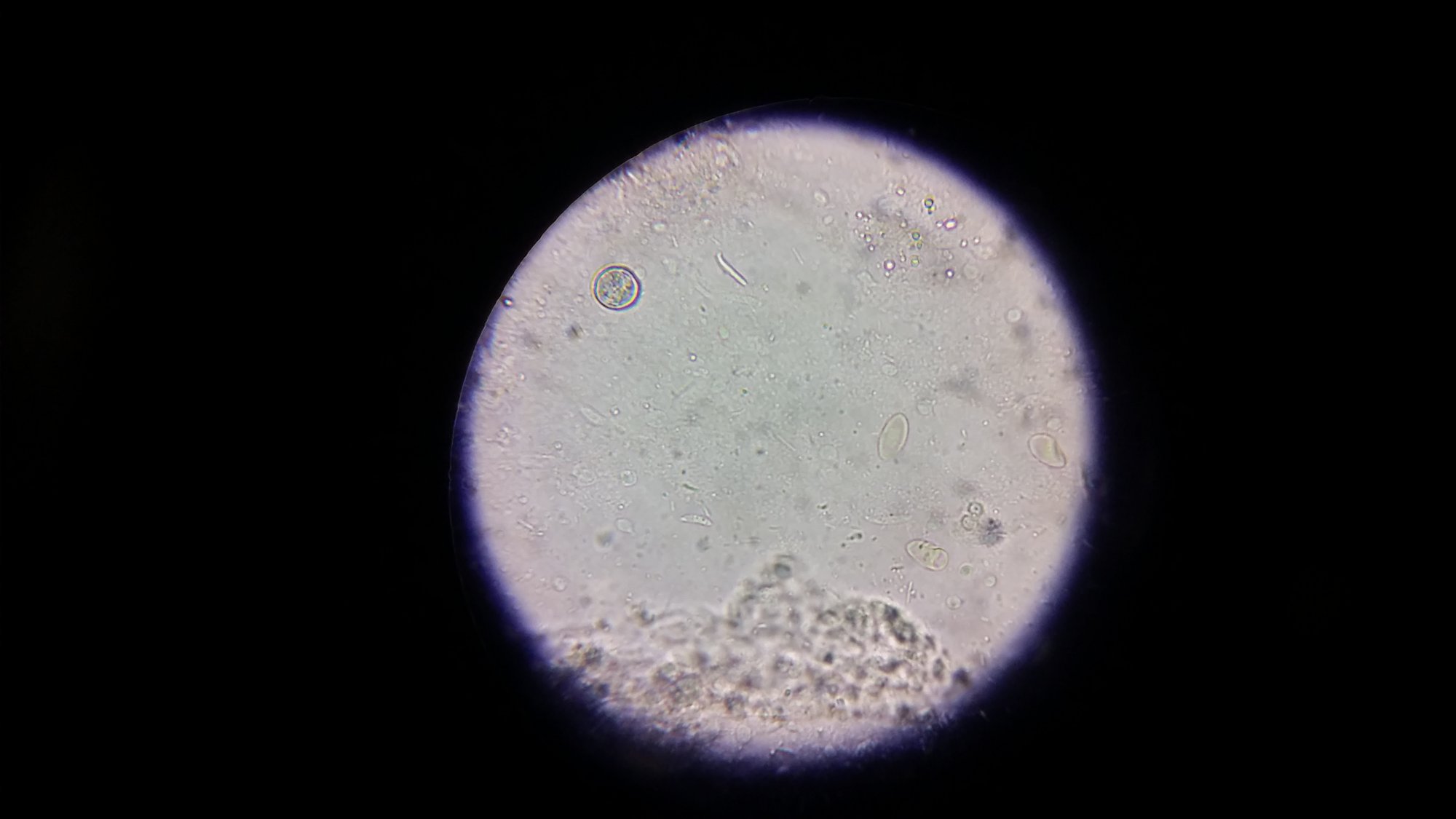 Coccidia Invasive Forms under microscope