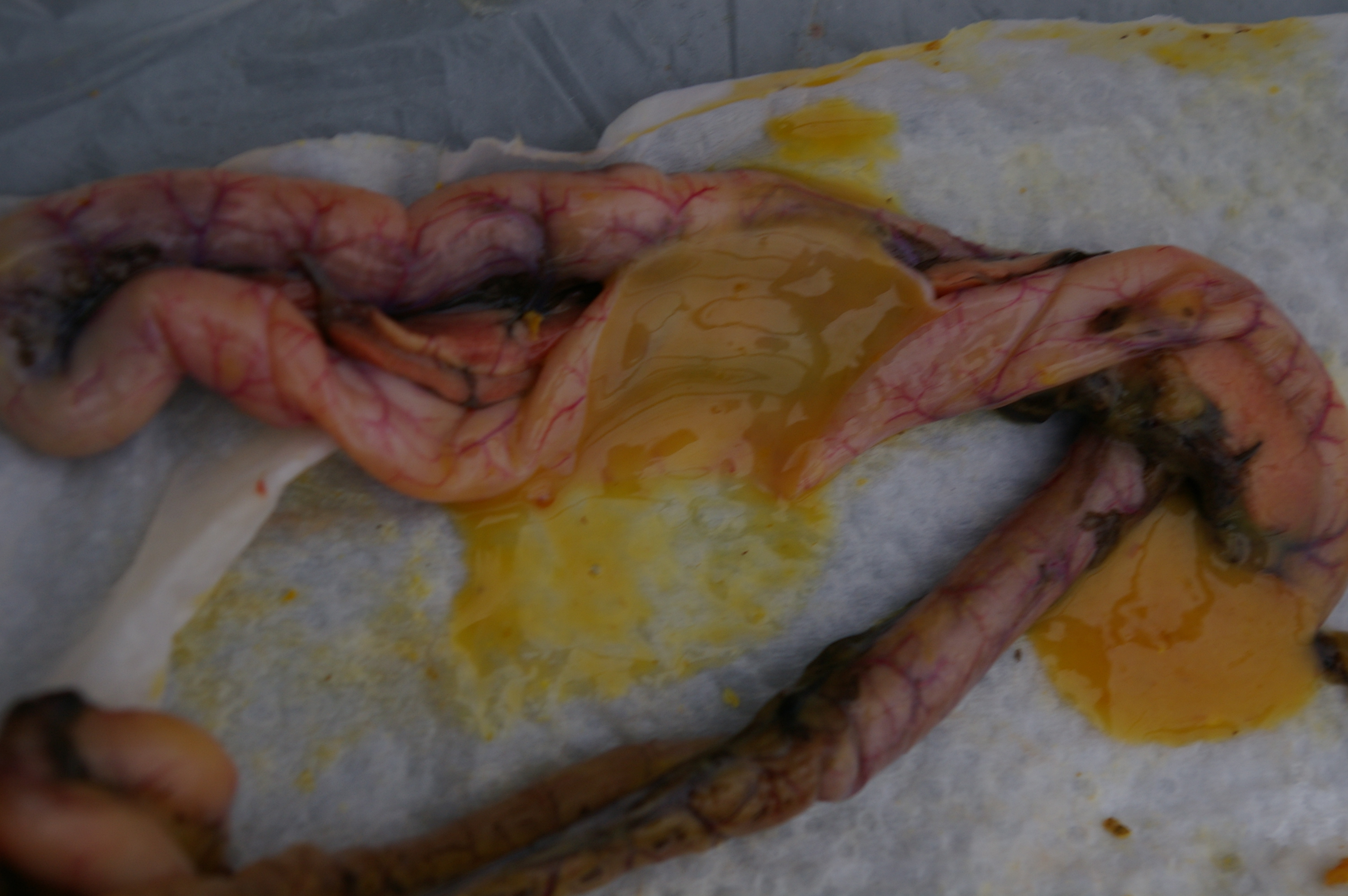 Duodenum contents