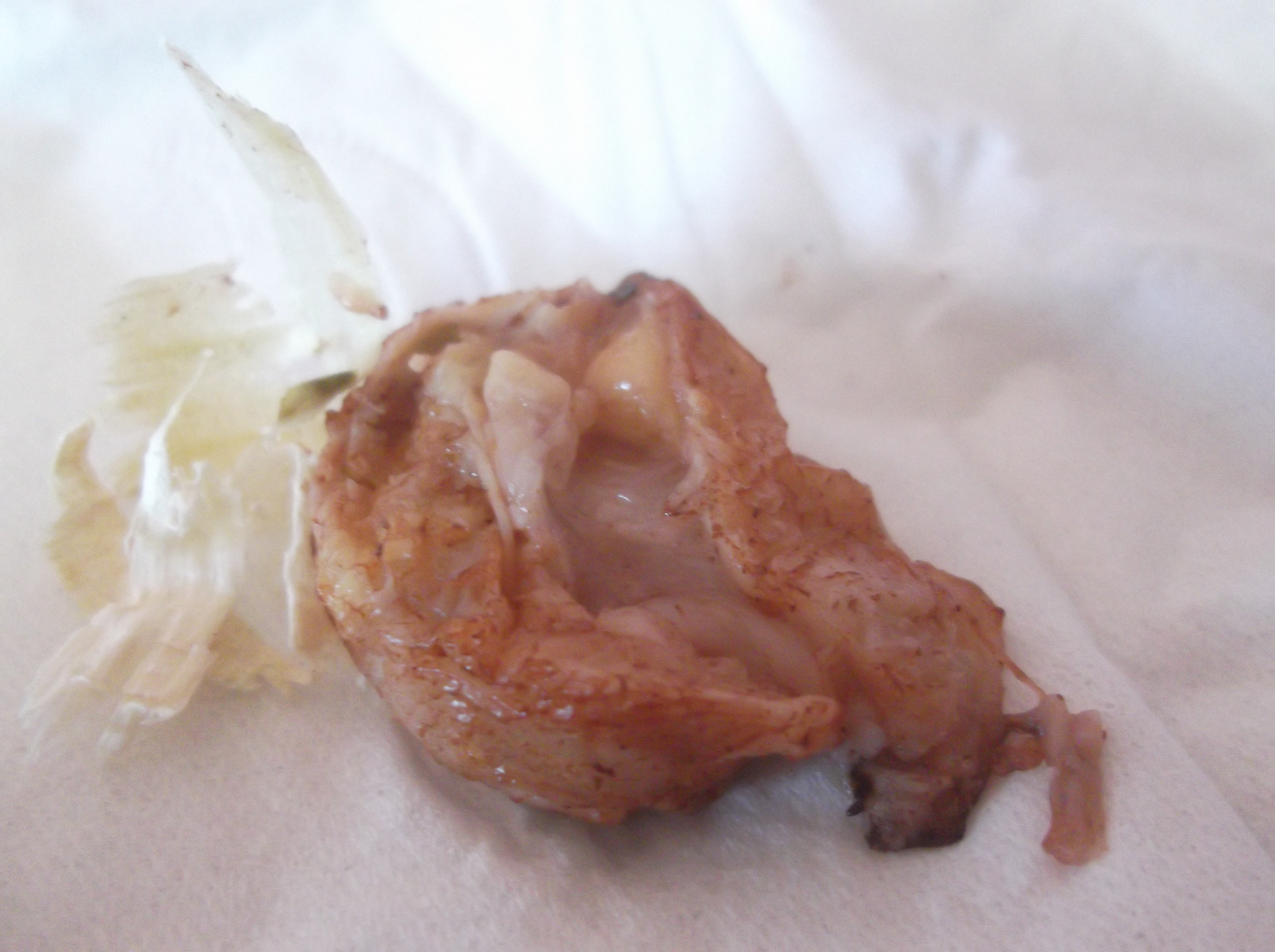 Found in her bedding, intestinal lining?