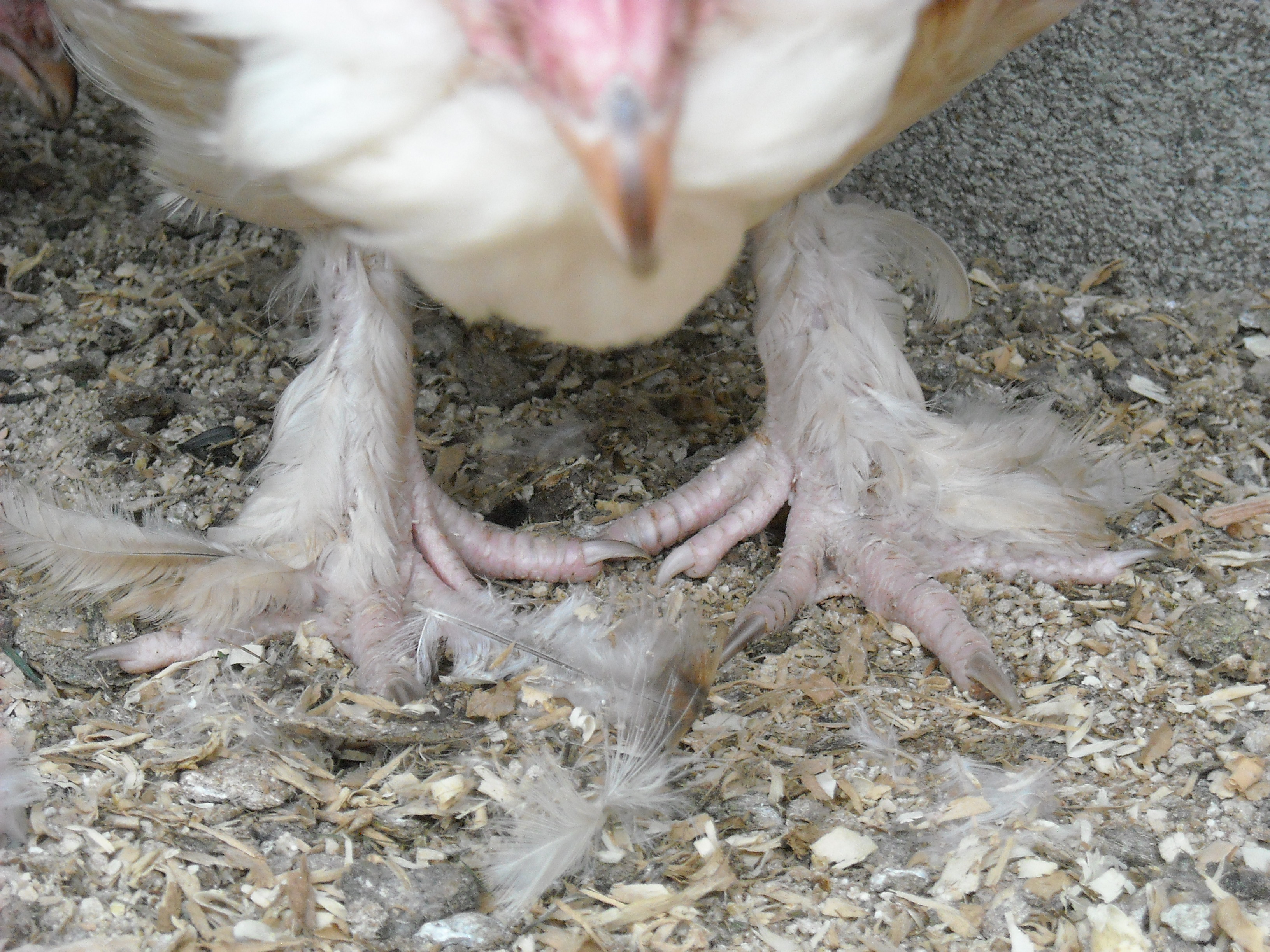 frontal view of feet