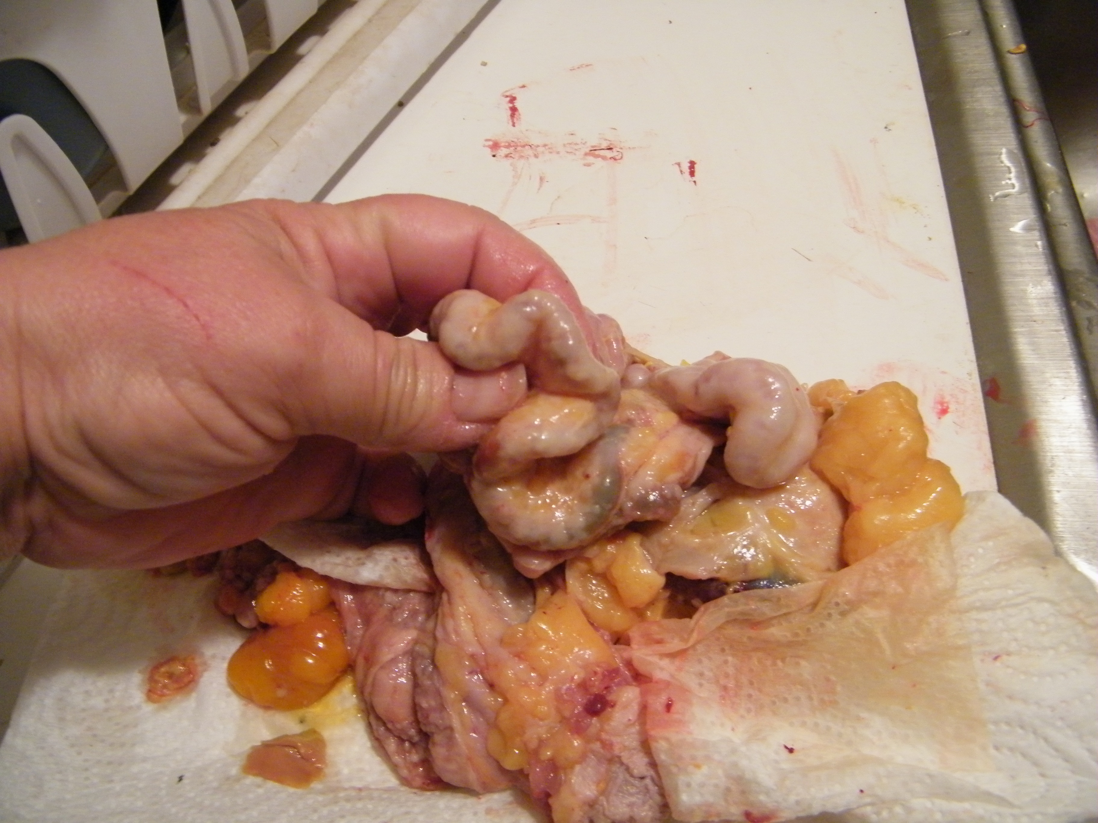 I believe this is the duodenum.  It was quite stiff and hard.