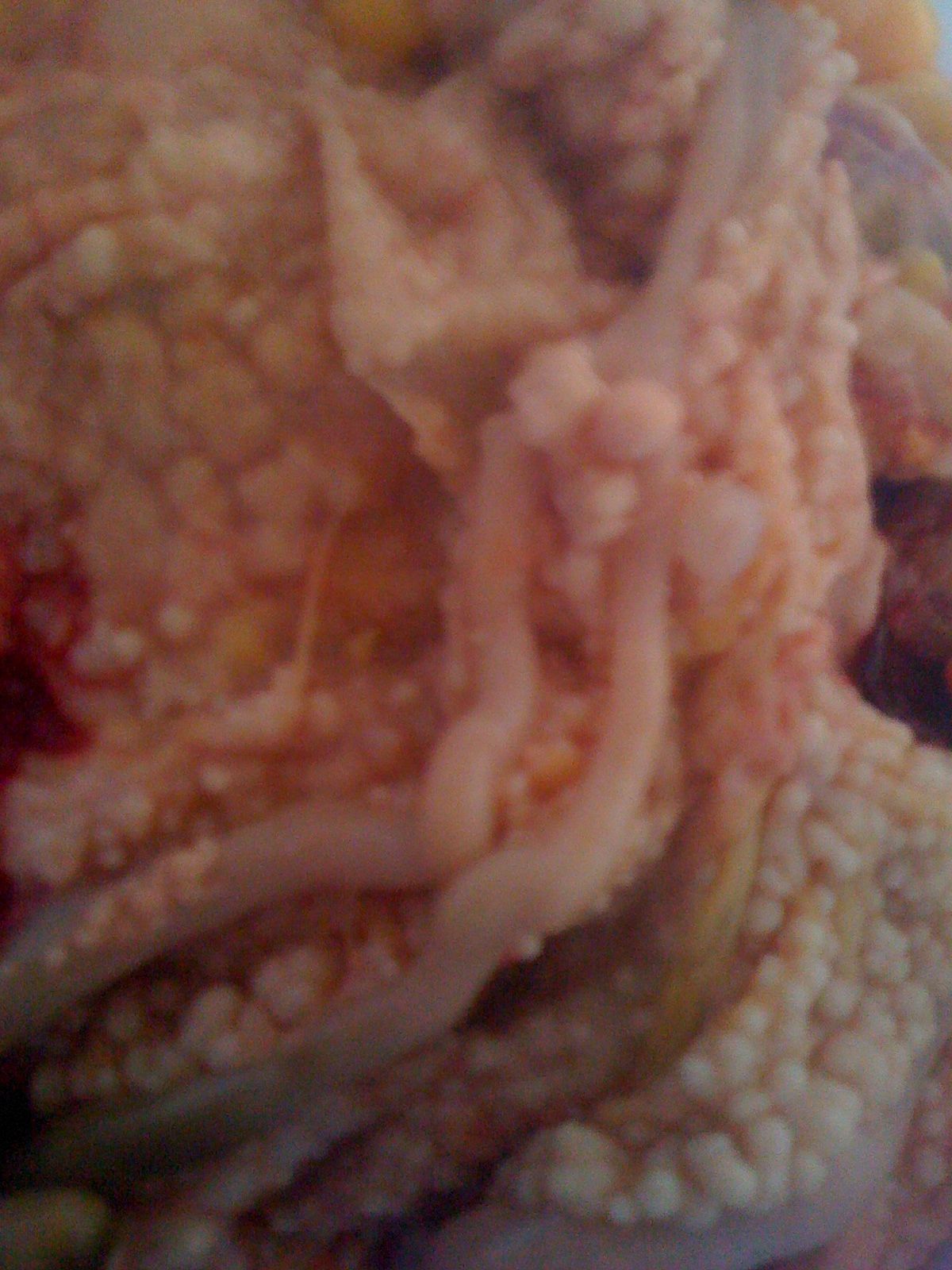 I discovered my chicken was egg bound, once I opened her up lots of fluid poured out. And 
she had what looked like tumors or nodules all along her intestines. They look like round light beige\white cottage cheese curds. I cut open open, It was a capsule with white center. The vet does not know what they are and a sample can be sent to a lab to find out. Has any one else seen this or know what they are? I'll try and add pictures.