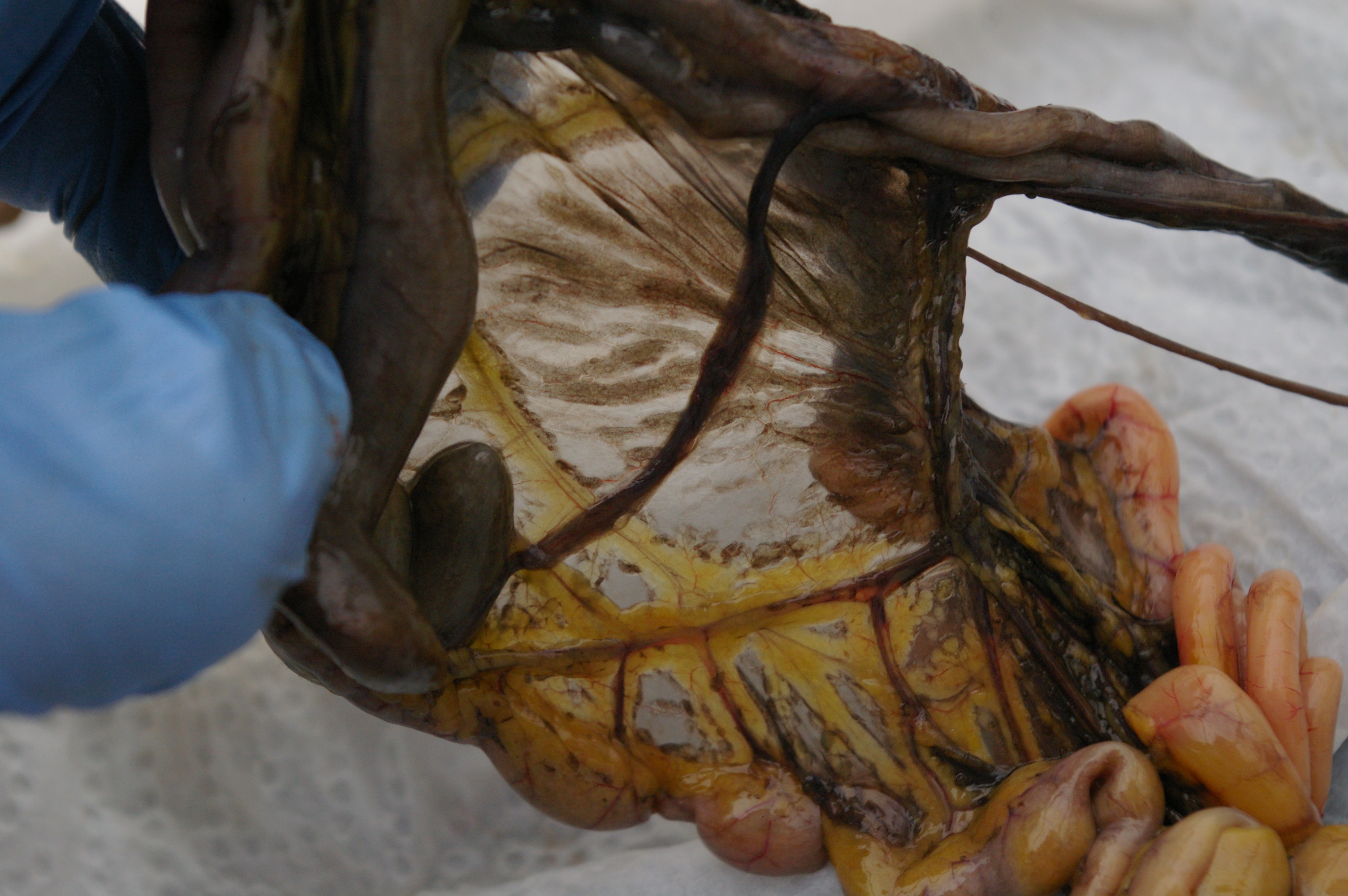 Intestinal blood supply. An intricate web designed to take nutrients from the bowel to the blood stream